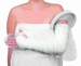 Gipshoes hele arm